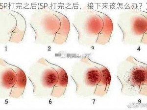 SP打完之后(SP 打完之后，接下来该怎么办？)