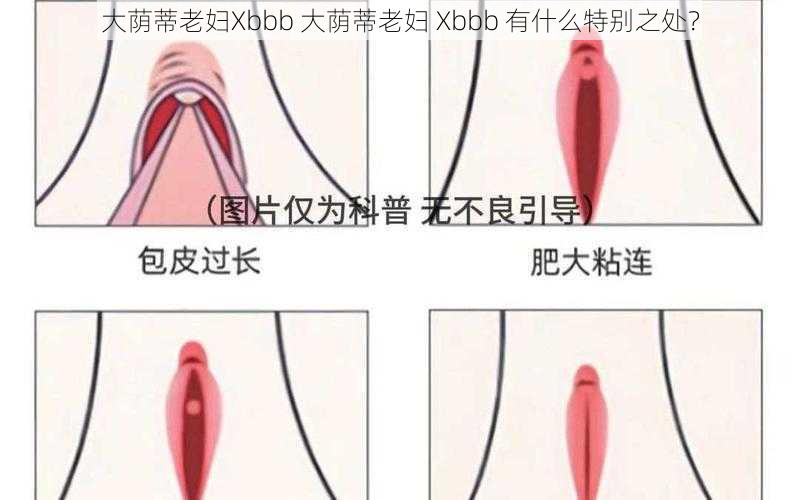 大荫蒂老妇Xbbb 大荫蒂老妇 Xbbb 有什么特别之处？