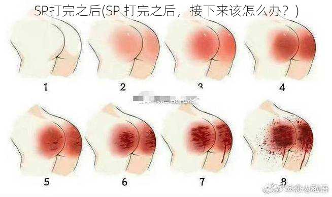 SP打完之后(SP 打完之后，接下来该怎么办？)